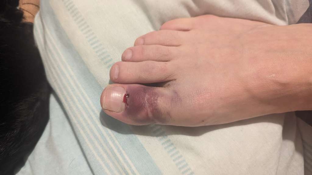 PXL_20231103_233750810